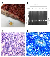 Jundishapur J Microbiol